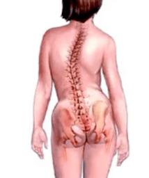 Pathology of the musculoskeletic system