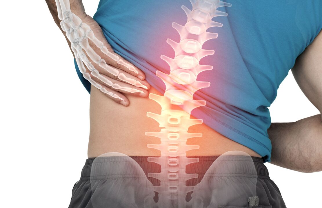 The danger of lumbar ostecondrosis