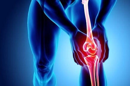 Osteoarthritis
