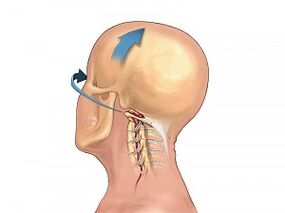 How the osteochondrosis of the cervical column manifests