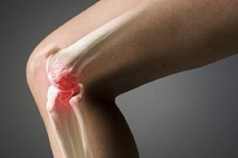 The osteoarthritis of the knee joint is a cartilage tissue injury